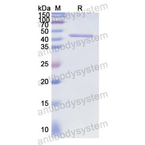 重組RB1蛋白,Recombinant Human RB1, N-GST