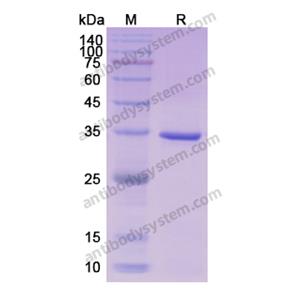 Recombinant Human CDK1, N-His