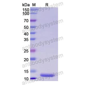 Recombinant Human ENO1, N-His