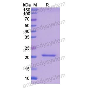 Recombinant Human PYGL, N-His