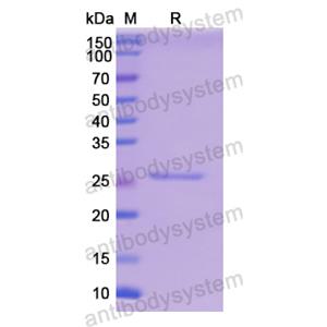 Recombinant Human GPI, N-His