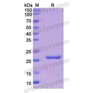 重组CD51/ITGAV蛋白,Recombinant Human CD51/ITGAV, N-His