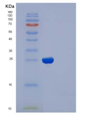 Recombinant Human CD122 / IL-2RB Protein,Recombinant Human CD122 / IL-2RB Protein