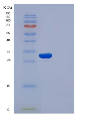 Recombinant Human APOA1 / ApoAI Protein (His tag),Recombinant Human APOA1 / ApoAI Protein (His tag)