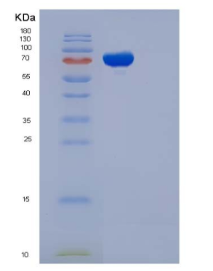 Recombinant Rat GFRA1 / GFR alpha-1 Protein (Fc tag),Recombinant Rat GFRA1 / GFR alpha-1 Protein (Fc tag)