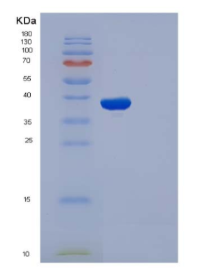 Recombinant Human SELP / selectin P / P-selectin Protein (His tag),Recombinant Human SELP / selectin P / P-selectin Protein (His tag)