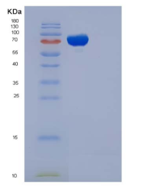 Recombinant Human Complement C5a Protein,Recombinant Human Complement C5a Protein