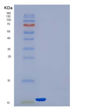 Recombinant Human Thioredoxin / TXN / SASP Protein,Recombinant Human Thioredoxin / TXN / SASP Protein