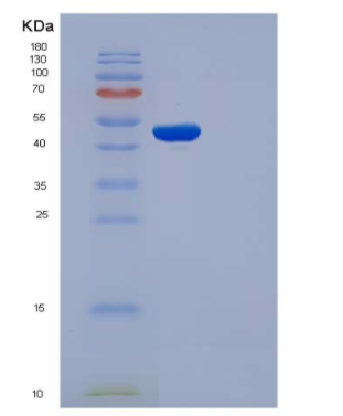 Recombinant Mouse CDC37 / CDC37A Protein,Recombinant Mouse CDC37 / CDC37A Protein