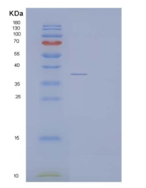 Recombinant Human ACYP1 Protein (GST Tag),Recombinant Human ACYP1 Protein (GST Tag)