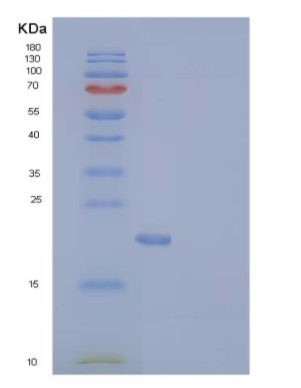 Recombinant Human CD137 / 4-1BB / TNFRSF9 Protein (His tag),Recombinant Human CD137 / 4-1BB / TNFRSF9 Protein (His tag)