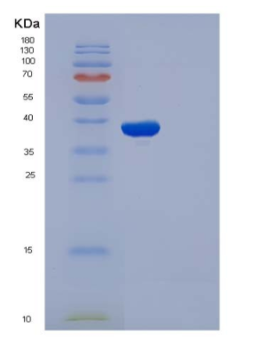 Recombinant Human IL1R1 / CD121a Protein (His tag),Recombinant Human IL1R1 / CD121a Protein (His tag)