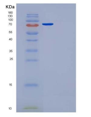 Recombinant Human Fibronectin / Fibronectin Fragment 2 Protein (His tag),Recombinant Human Fibronectin / Fibronectin Fragment 2 Protein (His tag)