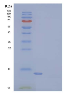 Recombinant Human LAIR2 / CD306 Protein, Low Endotoxin,Recombinant Human LAIR2 / CD306 Protein, Low Endotoxin