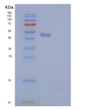 Recombinant Human RAB27B Protein (Fc tag),Recombinant Human RAB27B Protein (Fc tag)