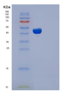 Recombinant Human TCN2 / Transcobalamin-II Protein (His tag),Recombinant Human TCN2 / Transcobalamin-II Protein (His tag)