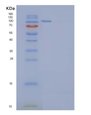 Recombinant Mouse AARS / alanyl-tRNA synthetase Protein (His tag),Recombinant Mouse AARS / alanyl-tRNA synthetase Protein (His tag)