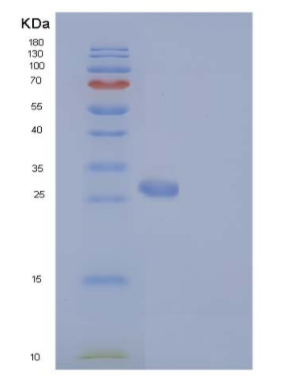 Recombinant Human IgG1-Fc Protein (103 Cys/Ser),Recombinant Human IgG1-Fc Protein (103 Cys/Ser)