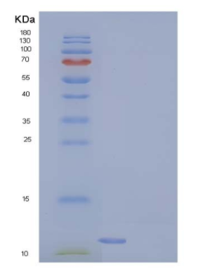 Recombinant Human COX5B Protein (His tag),Recombinant Human COX5B Protein (His tag)