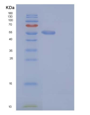 Recombinant Mouse S100A15 / S100A7A Protein (His & MBP tag),Recombinant Mouse S100A15 / S100A7A Protein (His & MBP tag)