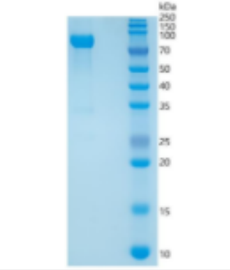 Recombinant Human MMP-2 Protein,Recombinant Human MMP-2 Protein