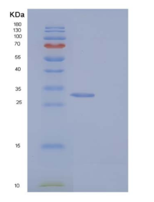 Recombinant Human BPHL Protein (His tag),Recombinant Human BPHL Protein (His tag)