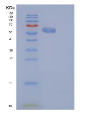 Recombinant Human CAT / Catalase Protein (His tag),Recombinant Human CAT / Catalase Protein (His tag)