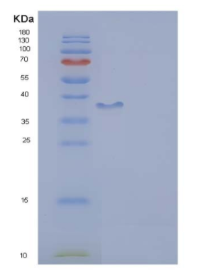 Recombinant Human DCX Protein (aa 45-150, GST tag),Recombinant Human DCX Protein (aa 45-150, GST tag)