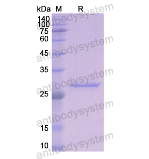 重組KLK1蛋白,Recombinant Human KLK1, N-His