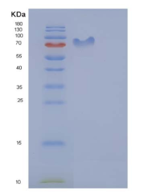 Recombinant Human CD50 / ICAM-3 Protein (His & Fc tag),Recombinant Human CD50 / ICAM-3 Protein (His & Fc tag)