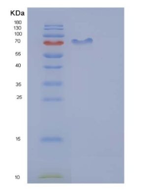 Recombinant Mouse CDC37 / CDC37A Protein (His & GST tag),Recombinant Mouse CDC37 / CDC37A Protein (His & GST tag)
