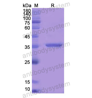 重组DBI蛋白,Recombinant Human DBI, N-GST