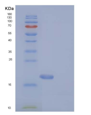 Recombinant Human MAGOH Protein (His tag),Recombinant Human MAGOH Protein (His tag)