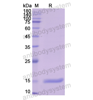 重组FABP1蛋白,Recombinant Human FABP1, N-His