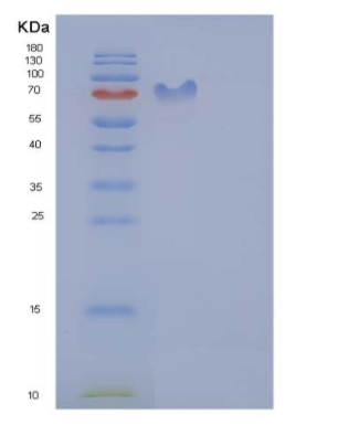 Recombinant Rat PDGFRB / PDGFR-1 Protein (Fc tag),Recombinant Rat PDGFRB / PDGFR-1 Protein (Fc tag)