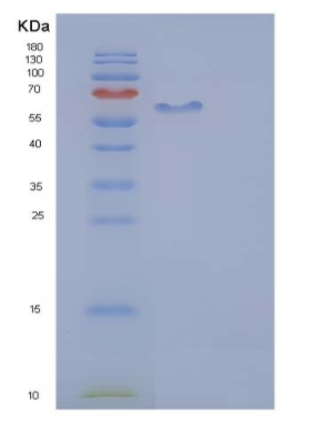 Recombinant Human AFM / Afamin Protein (His tag),Recombinant Human AFM / Afamin Protein (His tag)