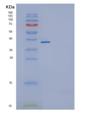 Recombinant Mouse IL11RA / IL11Rα Protein (His tag),Recombinant Mouse IL11RA / IL11Rα Protein (His tag)