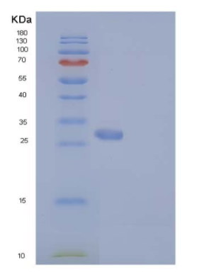Recombinant Human RAB27B Protein (His tag),Recombinant Human RAB27B Protein (His tag)