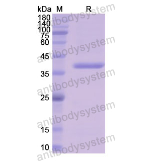 重组LDHB蛋白,Recombinant Human LDHB, N-His