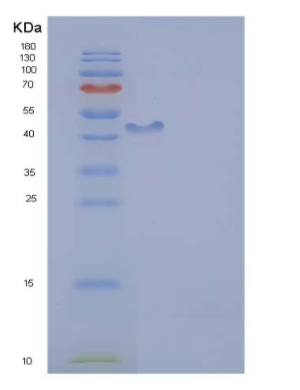 Recombinant Human ICAM-1 Protein,Recombinant Human ICAM-1 Protein