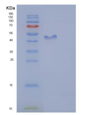 Recombinant Human ICAM-2 / CD102 Protein (His & Fc tag),Recombinant Human ICAM-2 / CD102 Protein (His & Fc tag)