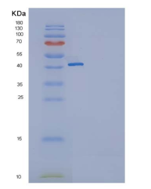 Recombinant Human GITR / TNFRSF18 Protein (Fc tag),Recombinant Human GITR / TNFRSF18 Protein (Fc tag)