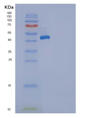 Recombinant Rat DDR2 Kinase / CD167b Protein (His tag),Recombinant Rat DDR2 Kinase / CD167b Protein (His tag)