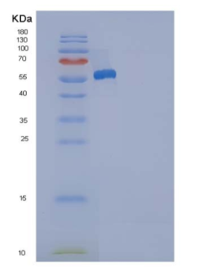 Recombinant Human ANP32A / PHAP1 Protein (His & GST tag),Recombinant Human ANP32A / PHAP1 Protein (His & GST tag)