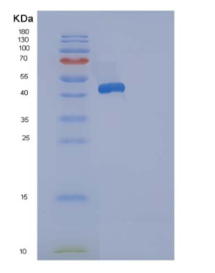 Recombinant Human ACP1 / LMW-PTP Protein (GST tag),Recombinant Human ACP1 / LMW-PTP Protein (GST tag)