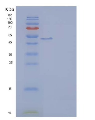 Recombinant Human IL2RG / CD132 Protein (Fc tag),Recombinant Human IL2RG / CD132 Protein (Fc tag)