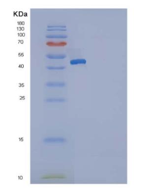 Recombinant Human SerpinG1 / C1 inhibitor / C1IN Protein (His tag),Recombinant Human SerpinG1 / C1 inhibitor / C1IN Protein (His tag)