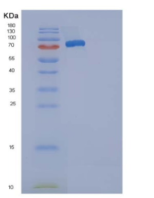 Recombinant Mouse SELP / selectin P / P-selectin Protein (His tag),Recombinant Mouse SELP / selectin P / P-selectin Protein (His tag)