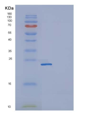 Recombinant Human CD32a / FCGR2A Protein (167 His, His & AVI tag), Biotinylated,Recombinant Human CD32a / FCGR2A Protein (167 His, His & AVI tag), Biotinylated