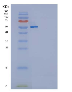 Recombinant Rat KIT / c-KIT Protein (His tag),Recombinant Rat KIT / c-KIT Protein (His tag)